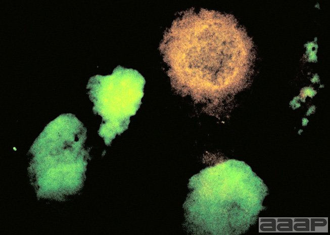 Plaques are produced in cell culture by three different strains (C, T, and V) of IBDV. The C & T strains have a mixture of large and small plaques. The V strain is a cloned strain of IBDV and has only the large plaque. alt