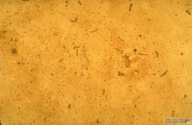 Low magnification (4X) micrograph 48 hours after infection showing unstained monolayers of CEL cells containing individual ILTV plaques. Slide 15