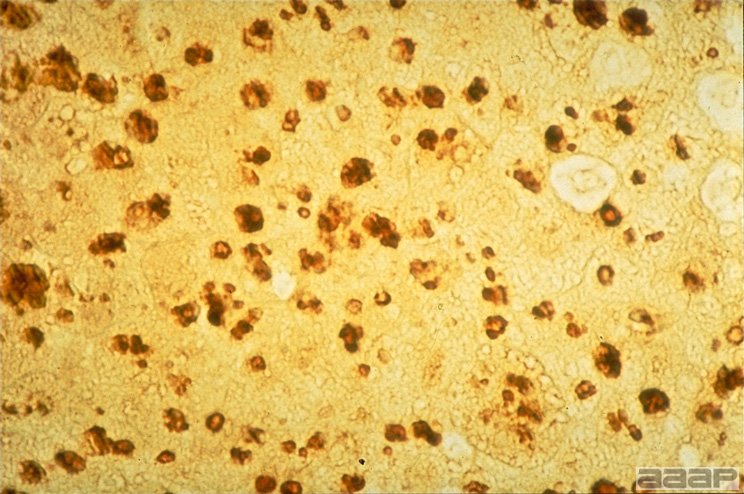Section of infected CAM showing cytoplasmic inclusions of fowlpox virus (Feulgen reaction indicating presence of DNA material). Slide 18