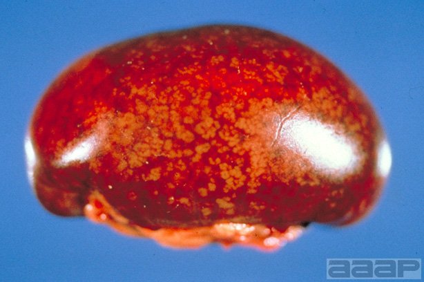 Enlarged and mottled spleen in acute fowl cholera turkey. Slide 14