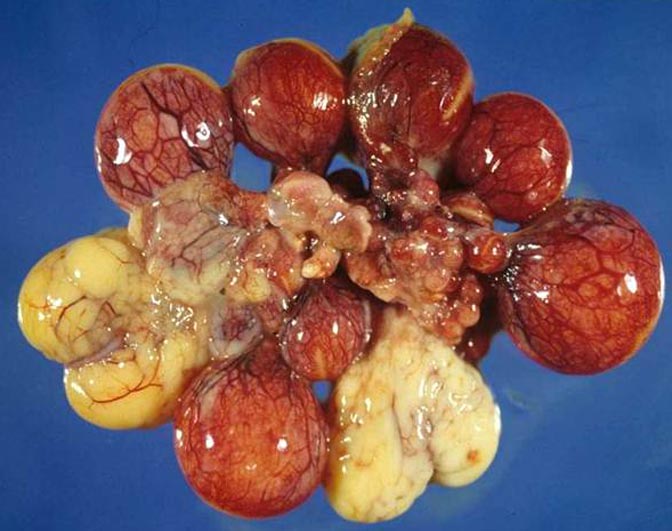 Turkey ovary with atretic and congested follicles Turkey ovary with atretic and congested follicles
