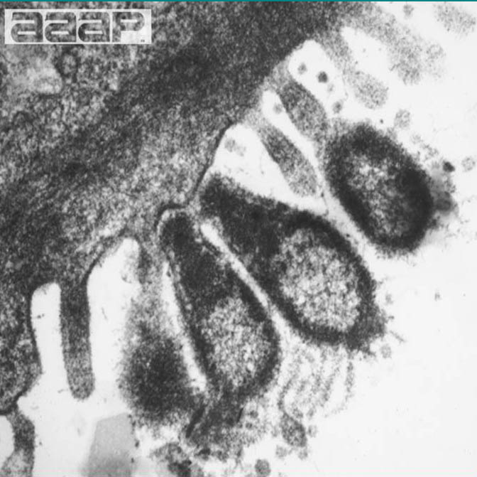 MG attaching to tracheal epithelium alt