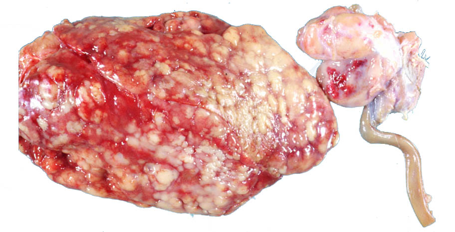 Gross RE bursal tumor Slide 8
